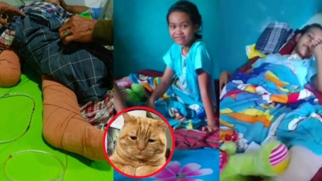 Kondisi Terkini Kesehatan Nabila